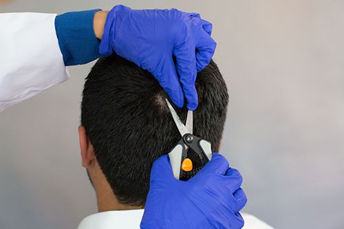 Do Hair Follicle Tests Detect Alcohol?