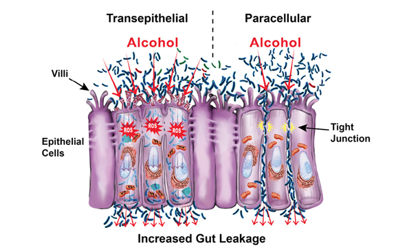 does-alcohol-cause-leaky-gut-recovery-ranger