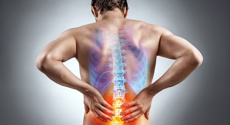 Does Alcohol Make Sciatica Worse